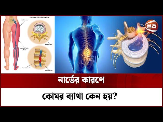 নার্ভের কারণে কোমর ব্যাথা কেন হয়? | Back Pain | Channel 24