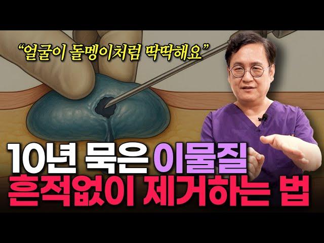 "이물질 제거하다 큰일 납니다" 불법 시술을 받으면 위험한 이유