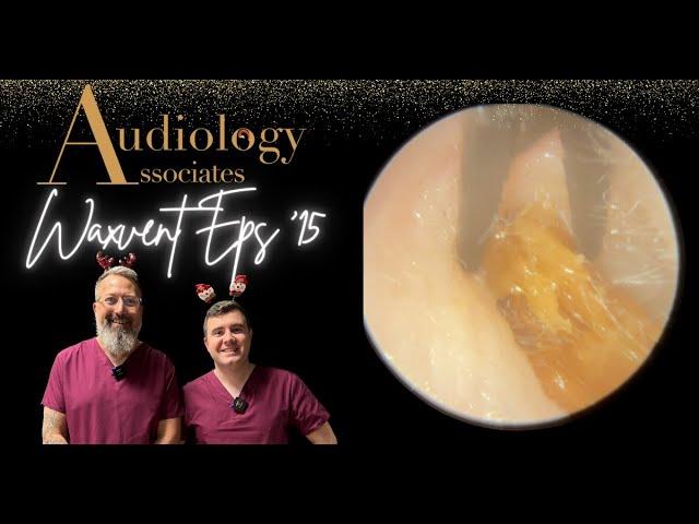 DEEP EAR WAX PLUG REMOVAL - WAXVENT 15