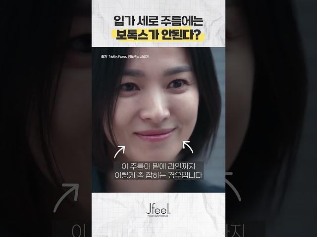 입가 세로 주름은 보톡스로 잡을 수 없을까?