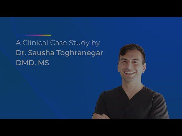 Clinical Case Study: Guided Tissue Regeneration Between a Natural Tooth and an Implant