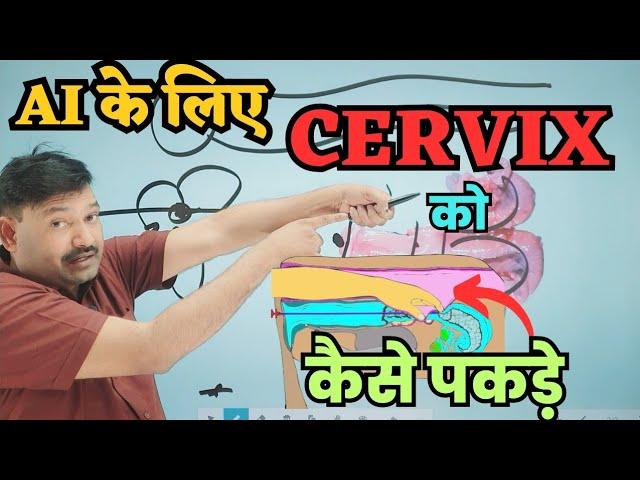 AI के लिए सर्विक्स ऐसे पकड़ें AI Gun Pass karne ka tarika / Cervix ko kaise Pakde