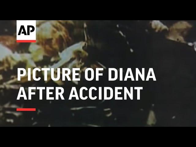 France - Picture of Diana after accident