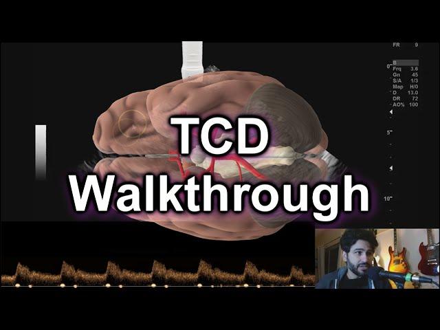 TCD Protocol Walkthrough