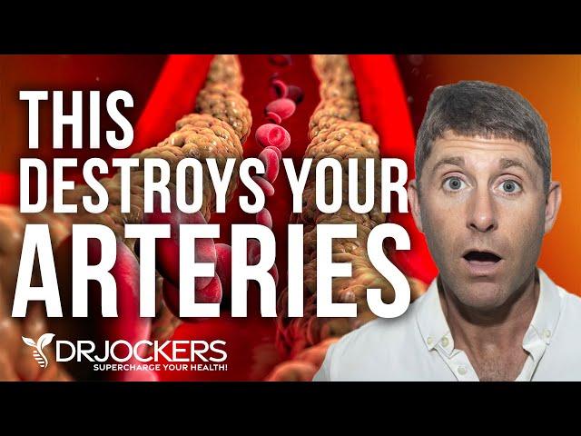 How High Blood Sugar Destroys Your Arteries & How To Fix It