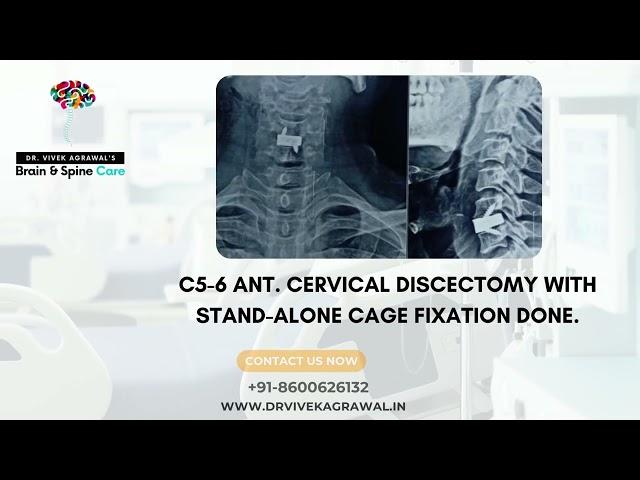 Dr. Vivek Agrawal  - Best Spine surgeon In Nagpur. Cervical spine surgery in nagpur.