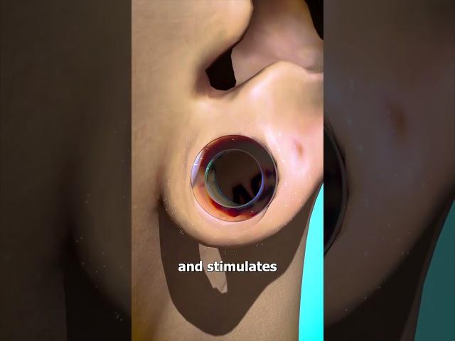 How Ear Gauges Can Tear Your Ears 