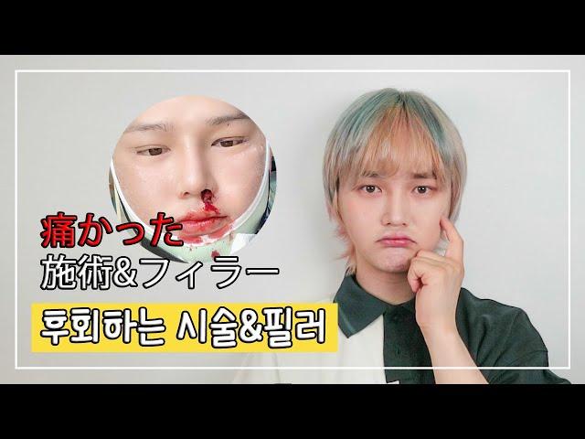 가장 아팠던, 후회하는 시술&필러ㅣ비글S2 BeagleS2 