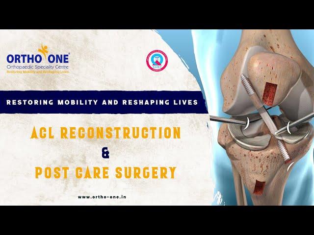 Best ACL reconstruction and Post surgery care@orthooneorthopaedicspecial831 #orthopedics