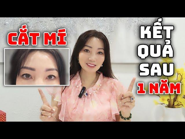 KT Có Hối Hận Khi Cắt Mí Mắt? Có Nên Hút Mỡ Bụng Không? Review Sau 1 Năm Phẩu Thuật Thẩm Mỹ