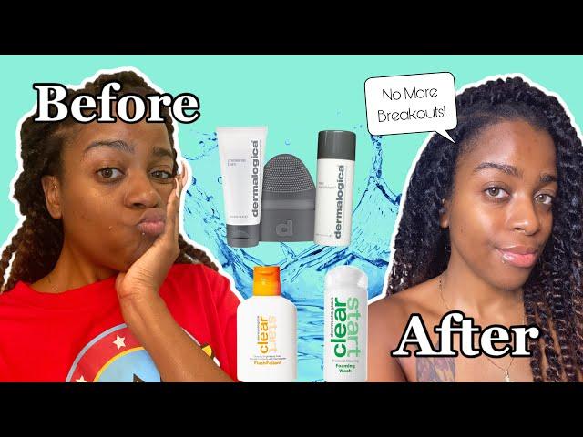 Dermalogica Nighttime Skincare Routine for Oily / Acne Prone Skin