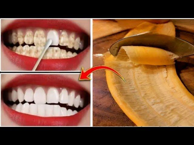 This home remedy will make your yellow, dirty teeth shine like pearls in just 2 minutes / Teeth Whit