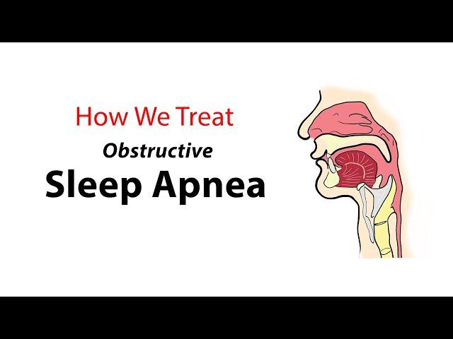 How We Treat Obstructive Sleep Apnea