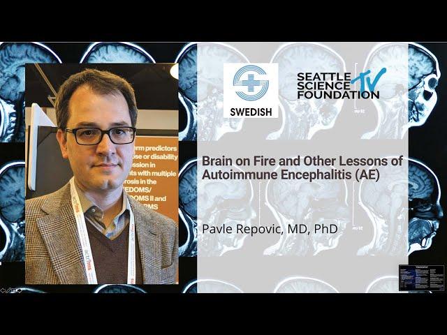 Brain on Fire & Other Lessons  of Autoimmune Encephalitis - Pavel Repovic, MD