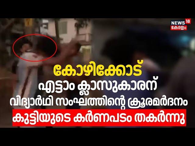 Kozhikode എട്ടാം ക്ലാസുകാരന് ക്രൂര മര്‍ദനം; കുട്ടിയുടെ കര്‍ണ പടം തകര്‍ന്നു| Kozhikode Student Attack