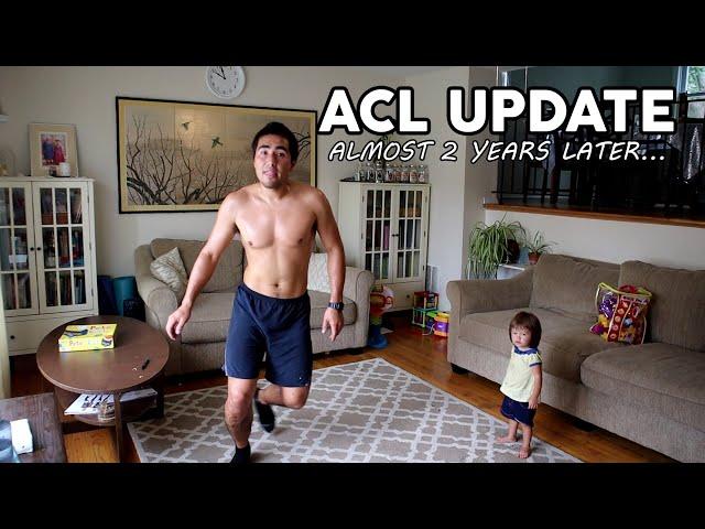 ACL Surgery Recovery - Year 2 - Recovery Level, Sports, Exercise Routine, Tips