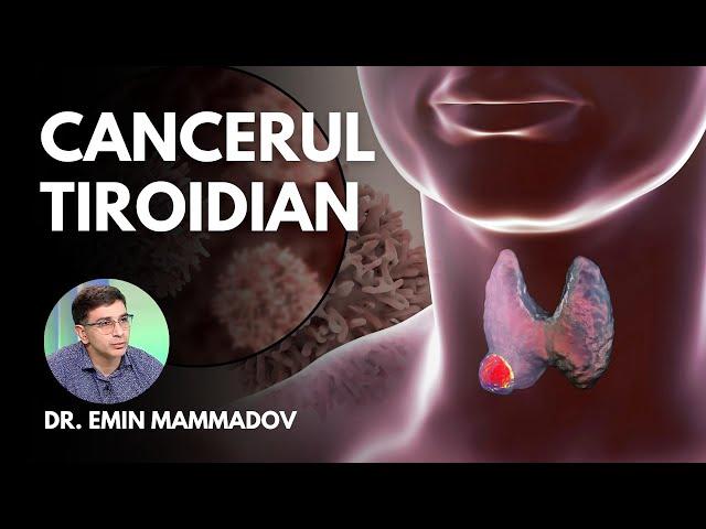 CE TREBUIE SĂ ȘTII DESPRE CANCERUL TIROIDIAN | Dr. Emin Mammadov, medic specialist endocrinologie