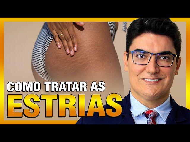 Como tratar as Estrias?