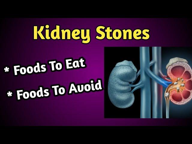 Kidney Stones Diet : Foods to Eat and Avoid