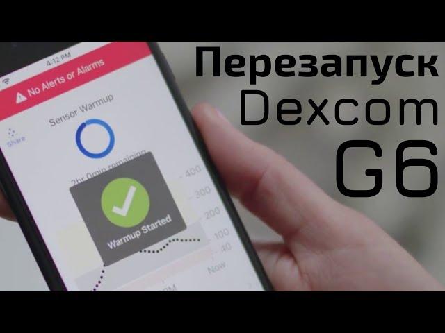 Перезапуск сенсора Dexcom G6! (80-я серия)