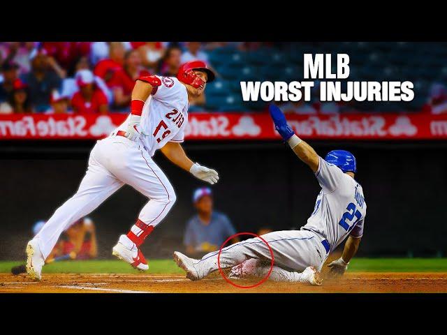 MLB Worst Injuries IN Baseball