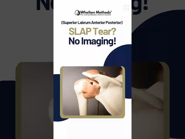 SLAP Tear Diagnosis Without Imaging