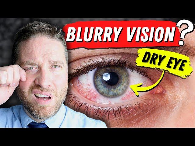 Why Dry Eyes Cause Blurry Vision - 3 Reasons, And 3 Home Remedies