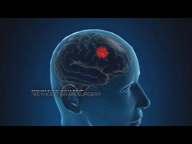 Defining Medicine - Neurology TV