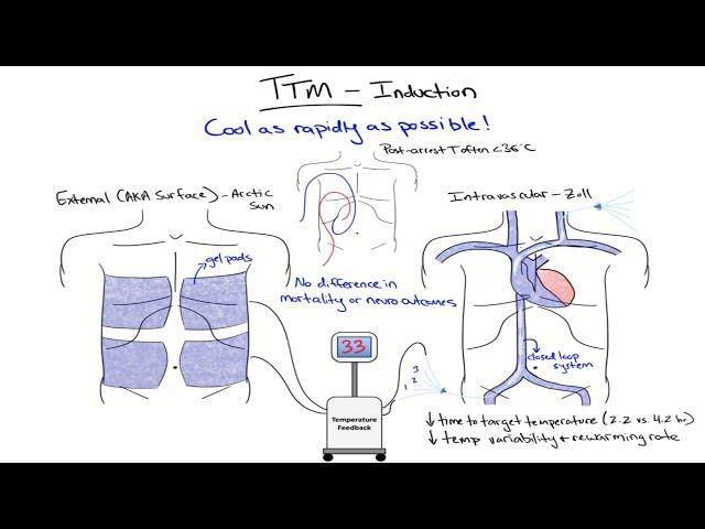 Chalk Talk: Targeted Temperature Management