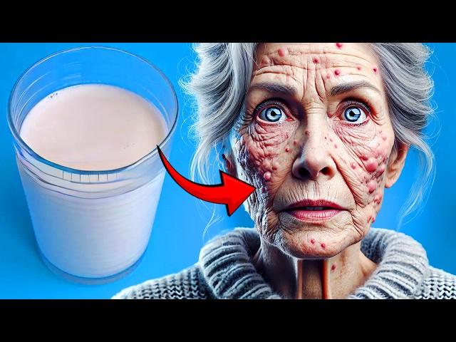 Avoid MILK If You Have These Health Problems