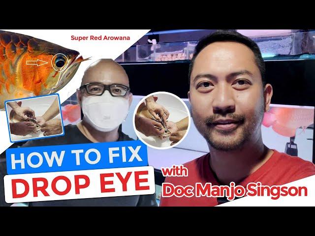 Drop eye surgery