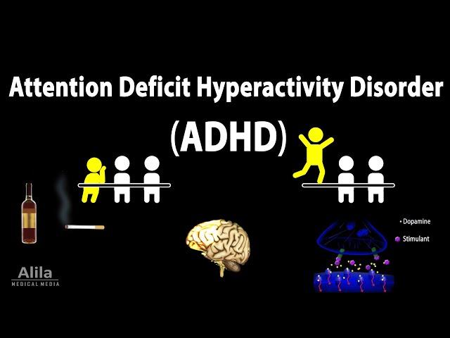 Attention Deficit Hyperactivity Disorder (ADHD), Animation