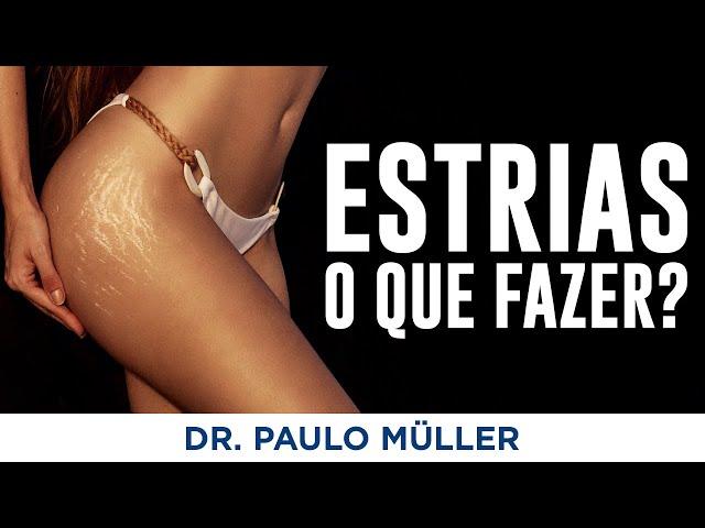 Estrias, Prevenção e Tratamento! – Dr. Paulo Müller Dermatologista.