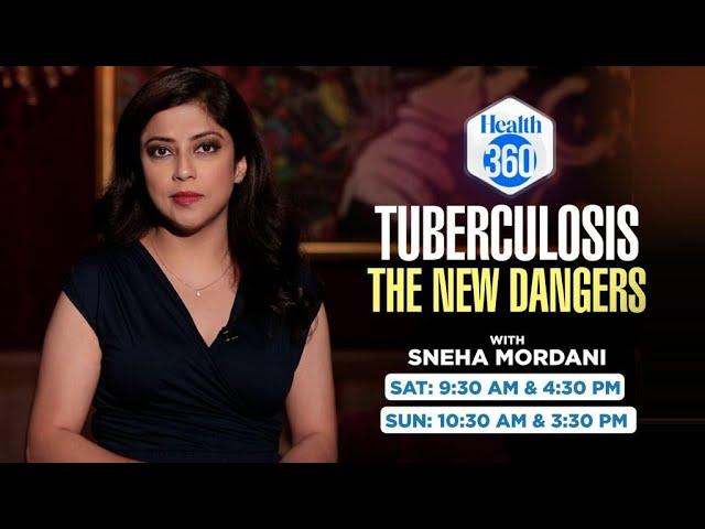 Take Lessons From Survivors In India’s Fight Against TB | Health 360