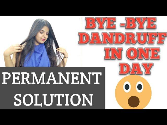 Dandruff removal at home || dandruff treatment in just 5 mins || get rid of dandruff in one day .