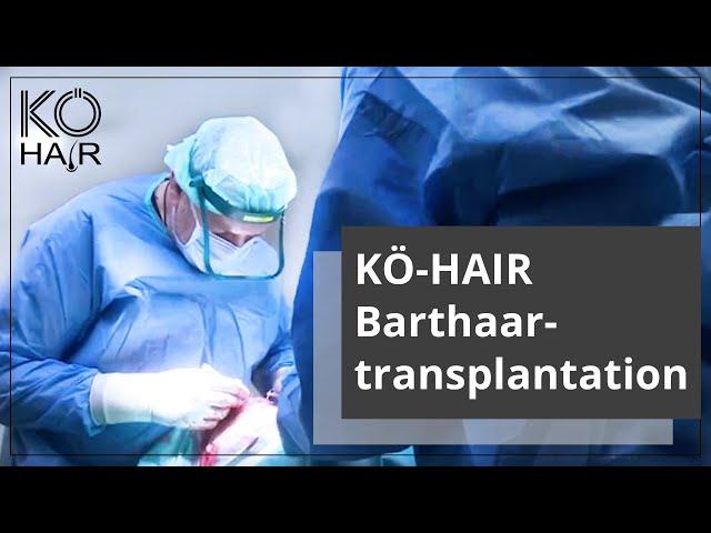 KÖ-HAIR Barthaartransplantation