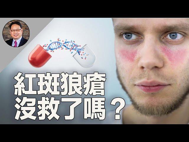 紅斑狼瘡=不死的癌症？揭秘誘發原因，分享自救指南！