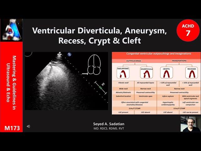 ACHD 7: Ventricular Diverticula, Aneurysm, Recess, Crypt & Cleft...