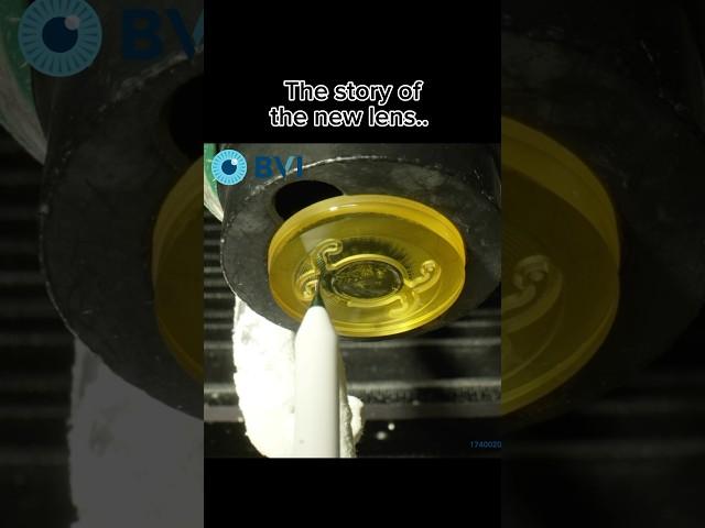 Every lens has a story