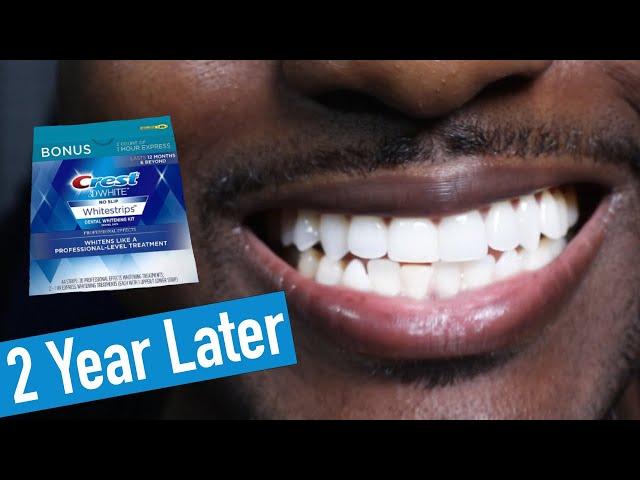 Crest 3D Whitestrips 2 Years Later: How to Whiten Teeth EASY!