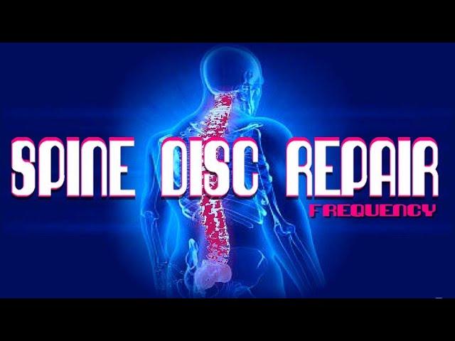 Spine Disc Repair Frequency