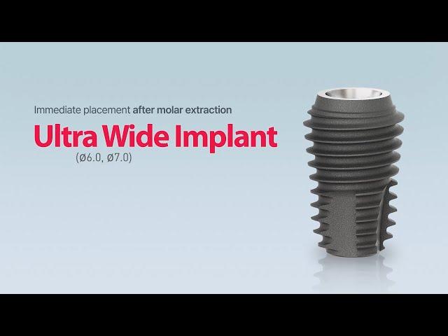 Ultra Wide-size Implant