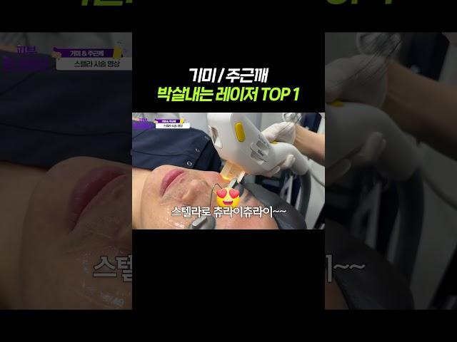 기미/주근깨 박살내는 레이저 TOP 1