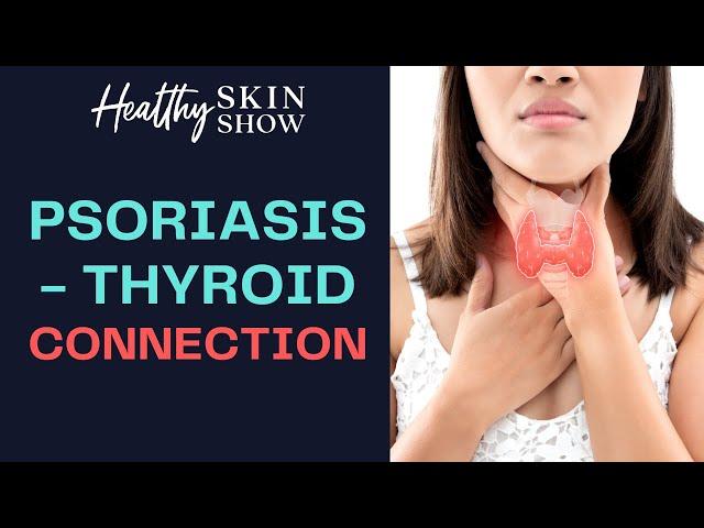 Psoriasis-Thyroid CONNECTION | Jennifer Fugo