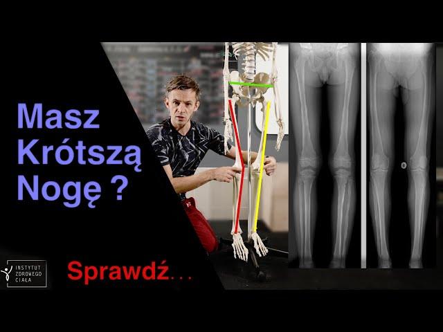 Sprawdź czy faktycznie masz krótsza nogę. Short leg. Skrót kończyny.