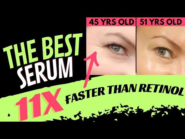 HOW TO LOOK 6 YEARS YOUNGER?! OVERNIGHT RESULTS!