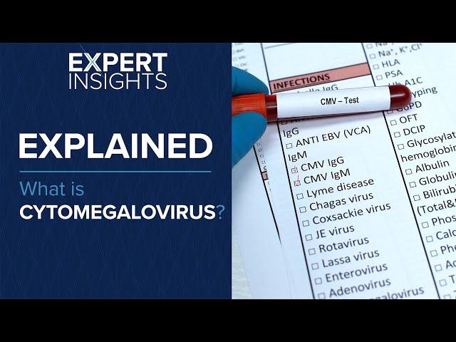 Expert Insights: What is cytomegalovirus (CMV)?