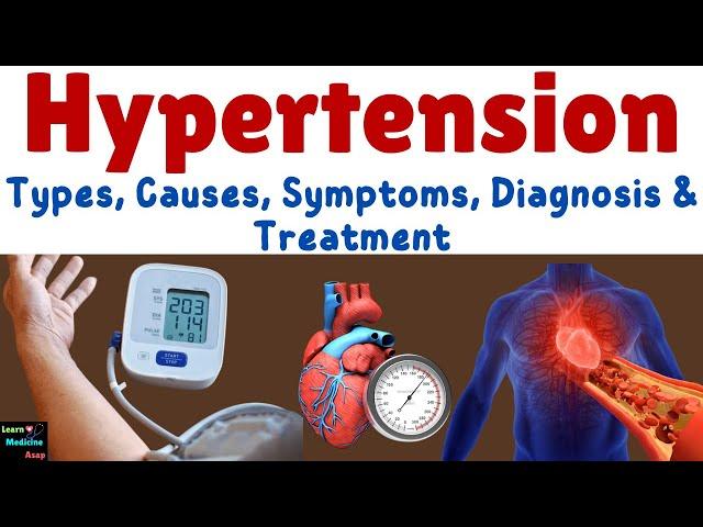 High Blood Pressure (Hypertension) – Causes, Symptoms, Diagnosis, Management, Pathophysiology