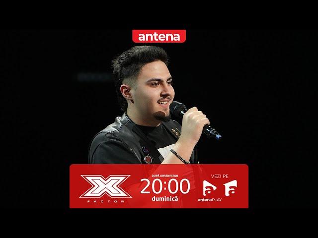  Din durere, a găsit inspirație! Tudor Gheorghe și povestea din spatele pasiunii pentru muzică