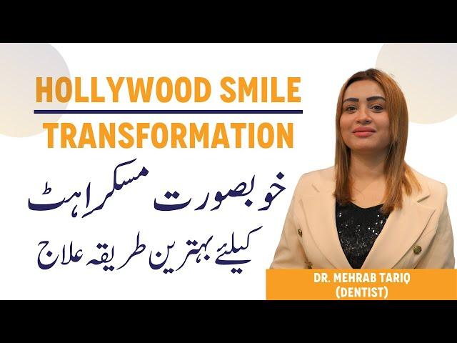 Hollywood Smile Transformation - Khubsurat Muskurahat Ka Ilaj - Smile Makeover Cost In Pakistan